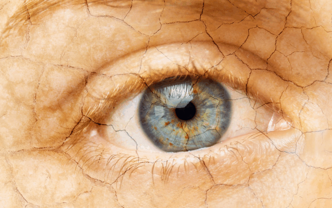 Understanding Ocular Allergies: Expert Insights from Dr. McCoy