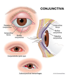 Conjunctiva Medical Illustration for patient education at Southwestern Eye Center in Arizona