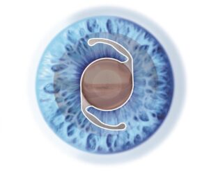 Close-up illustration of a blue iris with a brown circular center.