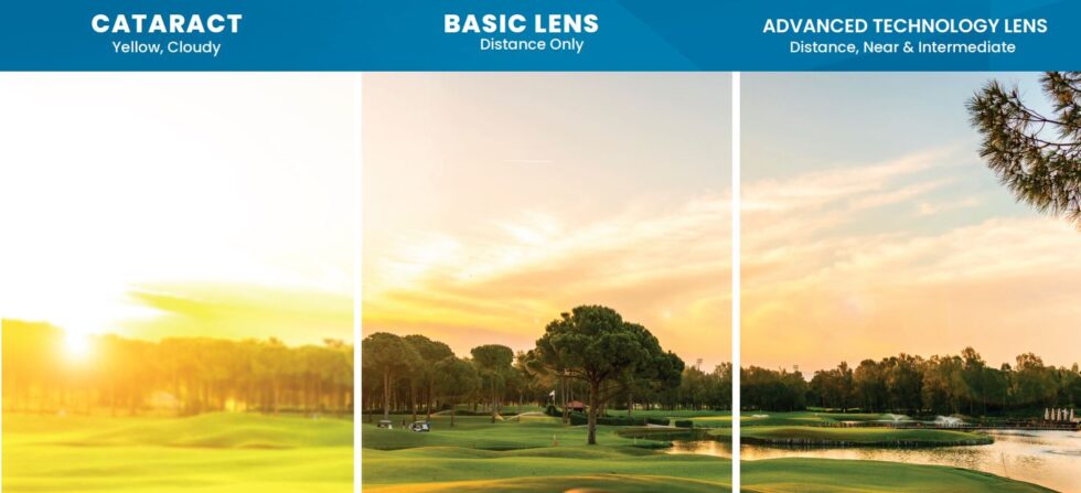Graphic of a landscape with three panels showing the difference between lens options.