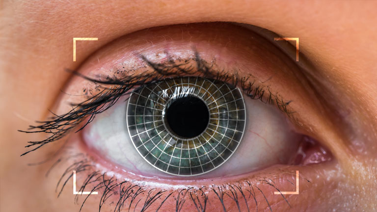Selective laser trabeculoplasty imagery that shows the inner lens grid.
