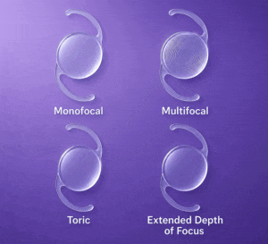 Selecting the right lens option will determine your cataract surgery cost at Southern Eye Center.